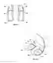 Fig. 30 - Apparatus and Method for Sculpting the Surface of a Joint
