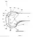Fig. 32 - Apparatus and Method for Sculpting the Surface of a Joint