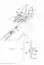 Fig. 35 - Apparatus and Method for Sculpting the Surface of a Joint