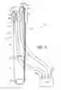 Fig. 02 - Deployable constrictor for uterine artery occlusion