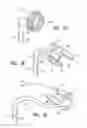 Fig. 05 - Deployable constrictor for uterine artery occlusion