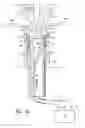 Fig. 07 - Deployable constrictor for uterine artery occlusion