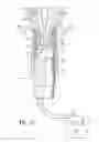 Fig. 09 - Deployable constrictor for uterine artery occlusion