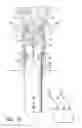 Fig. 10 - Deployable constrictor for uterine artery occlusion