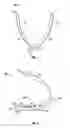 Fig. 02 - Surgical hemostatic clip