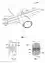 Fig. 05 - Surgical hemostatic clip