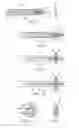 Fig. 04 - Device and method for establishing an artificial arterio-venous fistula