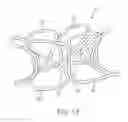 Fig. 06 - Device and method for establishing an artificial arterio-venous fistula
