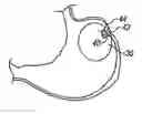 Fig. 01 - Magnetic anchoring devices