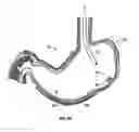 Fig. 03 - Magnetic anchoring devices