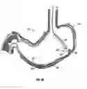 Fig. 04 - Magnetic anchoring devices