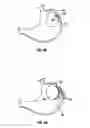 Fig. 06 - Magnetic anchoring devices