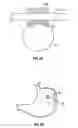 Fig. 08 - Magnetic anchoring devices