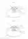 Fig. 04 - Apparatus and method for volume adjustment of intragastric balloons