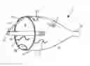 Fig. 01 - Embolic protection system