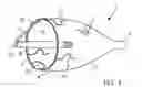 Fig. 02 - Embolic protection system