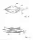 Fig. 20 - Embolic protection system