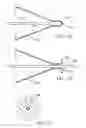 Fig. 32 - Embolic protection system