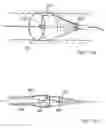 Fig. 42 - Embolic protection system
