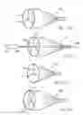 Fig. 45 - Embolic protection system