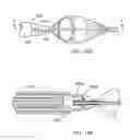 Fig. 50 - Embolic protection system