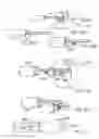 Fig. 55 - Embolic protection system