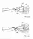 Fig. 62 - Embolic protection system