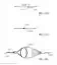 Fig. 66 - Embolic protection system