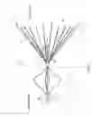 Fig. 02 - Retrievable blood clot filter