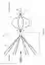 Fig. 15 - Retrievable blood clot filter