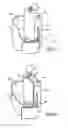 Fig. 03 - Method and system for external counterpulsation