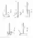 Fig. 02 - Methods and devices for percutaneously modifying organs to treat patients