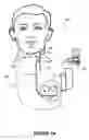 Fig. 02 - Stimulation mode adjustment for an implantable medical device