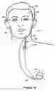 Fig. 03 - Stimulation mode adjustment for an implantable medical device