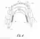 Fig. 05 - METHOD AND APPARATUS FOR PREVENTING OBSTRUCTIVE SLEEP APNEA