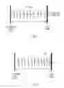 Fig. 07 - Method and apparatus for selecting and timing anti-tachyarrhythmia pacing using cardiac cycle length stability