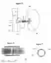 Fig. 12 - Renal nerve stimulation method for treatment of patients