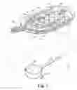 Fig. 02 - Method of reducing retinal stress caused by an implantable retinal electrode array