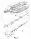 Fig. 04 - Method of reducing retinal stress caused by an implantable retinal electrode array