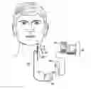 Fig. 01 - Spark gap in an implantable medical device