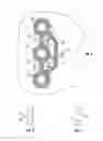 Fig. 03 - Spark gap in an implantable medical device