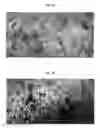Fig. 04 - METHODS AND DEVICES FOR EPITHELIAL PROTECTION DURING PHOTODYNAMIC THERAPY