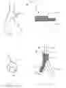 Fig. 02 - Bifurcation stent delivery system
