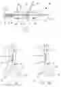 Fig. 04 - Bifurcation stent delivery system