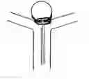 Fig. 01 - Aneurysm sealing device
