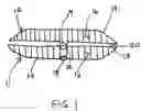 Fig. 02 - Aneurysm sealing device