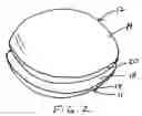 Fig. 03 - Aneurysm sealing device