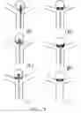 Fig. 05 - Aneurysm sealing device