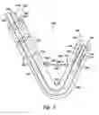 Fig. 04 - Translumenal apparatus, system, and method