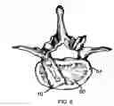 Fig. 06 - Interbody cage system